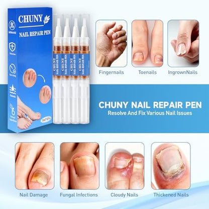 Extra Strength Nail Repair Pen - 4 Pack Nail Oil Cuticle Pens with Natural Plant Extracts for Repairing Discolored, Broken & Damaged Toenails - Effective Nail Repair Solution (Gold)