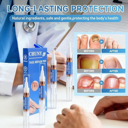 Extra Strength Nail Repair Pen - 4 Pack Nail Oil Cuticle Pens with Natural Plant Extracts for Repairing Discolored, Broken & Damaged Toenails - Effective Nail Repair Solution (Gold)