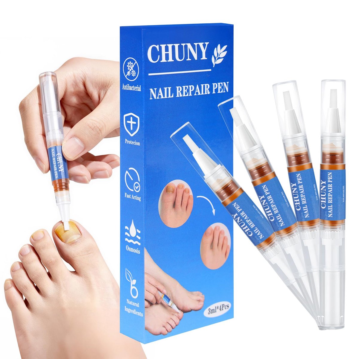 Extra Strength Nail Repair Pen - 4 Pack Nail Oil Cuticle Pens with Natural Plant Extracts for Repairing Discolored, Broken & Damaged Toenails - Effective Nail Repair Solution (Gold) - görsel 1