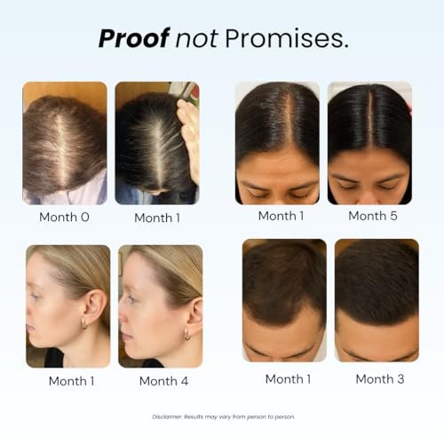 Growplex Revive Hair Strengthening Shampoo – Biotin, Caffeine, Rosemary & Niacinamide – Sulfate-Free – Thicker, Fuller-Looking Hair – 250ml Avelisse