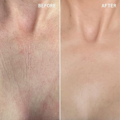 Beauty Pie Über Youth Neck & Chest Tightening Serum Spray – Firming Anti-Aging Serum for Neck & Chest, Lift & Tighten Skin, Hydrating Elasticity Boost, 3.2 fl oz Avelisse