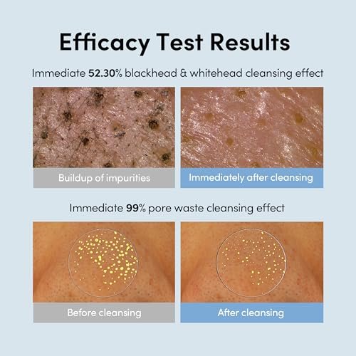 LAGOM Micro Pore Cleansing Oil – Daily Lightweight Makeup Remover & Blackhead Dissolver, Korean Skincare, 6.76 Fl Oz Avelisse