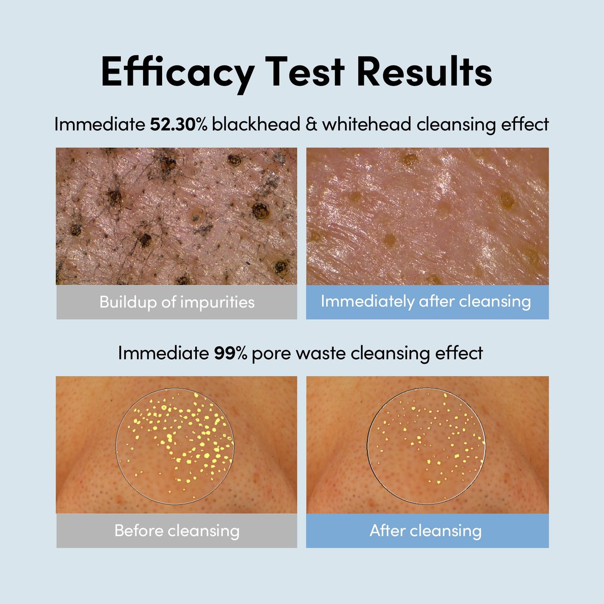 LAGOM Micro Pore Cleansing Oil – Daily Lightweight Makeup Remover & Blackhead Dissolver, Korean Skincare, 6.76 Fl Oz Avelisse