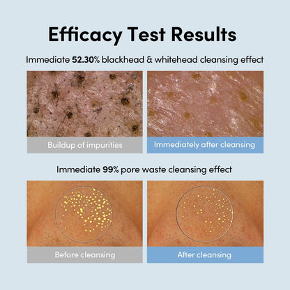 LAGOM Micro Pore Cleansing Oil – Daily Lightweight Makeup Remover & Blackhead Dissolver, Korean Skincare, 6.76 Fl Oz Avelisse