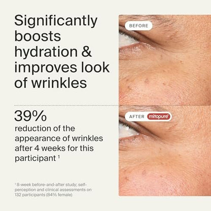 Timeline Mitopure™ Eye Cream – Anti-Aging Cream for Wrinkles, Dark Circles & Under Eye Bags with Urolithin A & Niacinamide – 0.67 Fl Oz Avelisse