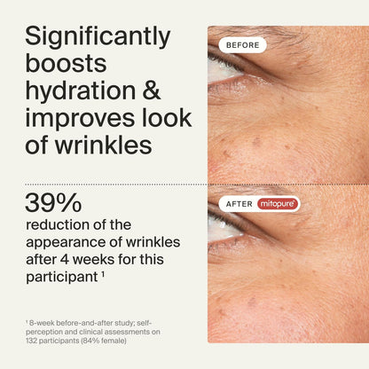 Timeline Mitopure™ Eye Cream – Anti-Aging Cream for Wrinkles, Dark Circles & Under Eye Bags with Urolithin A & Niacinamide – 0.67 Fl Oz Avelisse