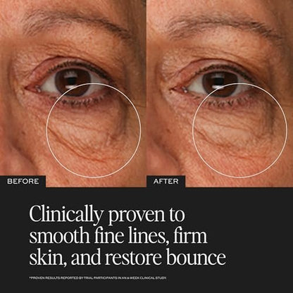 DIME Beauty TBT Eye Cream - Smooth Fine Lines, Firm Skin, Restore Bounce, Long Lasting Hydration with Bakuchiol (0.5 oz / 15 ml) Avelisse