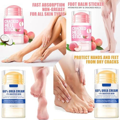 HJXUQIME 2-Pack 60% Urea Hydrating Foot Cream – Anti-Cracking Moisturizer for Dry Cracked Feet & Hands (Aloe + Peach)