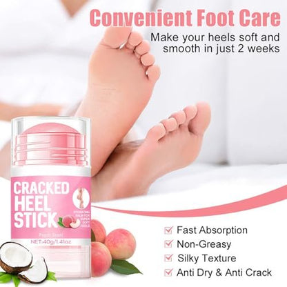 HJXUQIME 2-Pack 60% Urea Hydrating Foot Cream – Anti-Cracking Moisturizer for Dry Cracked Feet & Hands (Aloe + Peach)