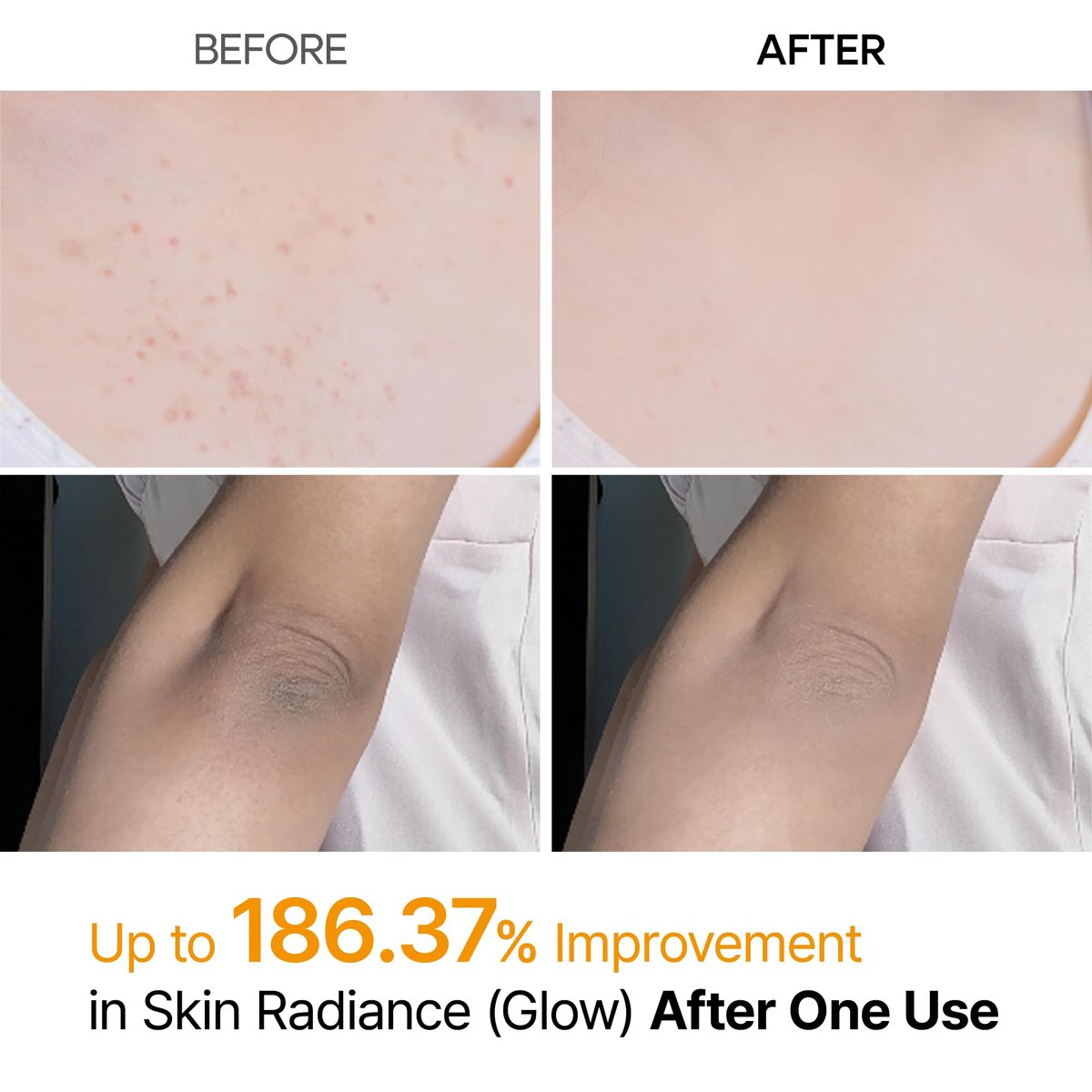 Dr.Melaxin Body Keratin Care Kojic Acid Turmeric Spray with AHA & PHA - Gentle Body Brightening & Exfoliating Peeling Solution, Korean Skincare, 6.76 fl.oz Avelisse