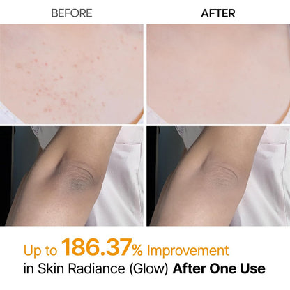 Dr.Melaxin Body Keratin Care Kojic Acid Turmeric Spray with AHA & PHA - Gentle Body Brightening & Exfoliating Peeling Solution, Korean Skincare, 6.76 fl.oz Avelisse