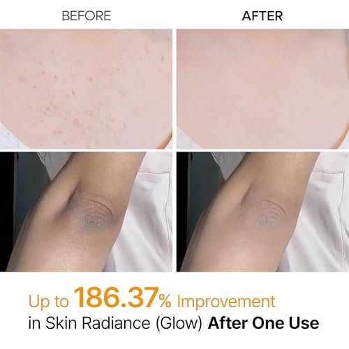 Dr.Melaxin Body Keratin Care Kojic Acid Turmeric Spray with AHA & PHA - Gentle Body Brightening & Exfoliating Peeling Solution, Korean Skincare, 6.76 fl.oz Avelisse
