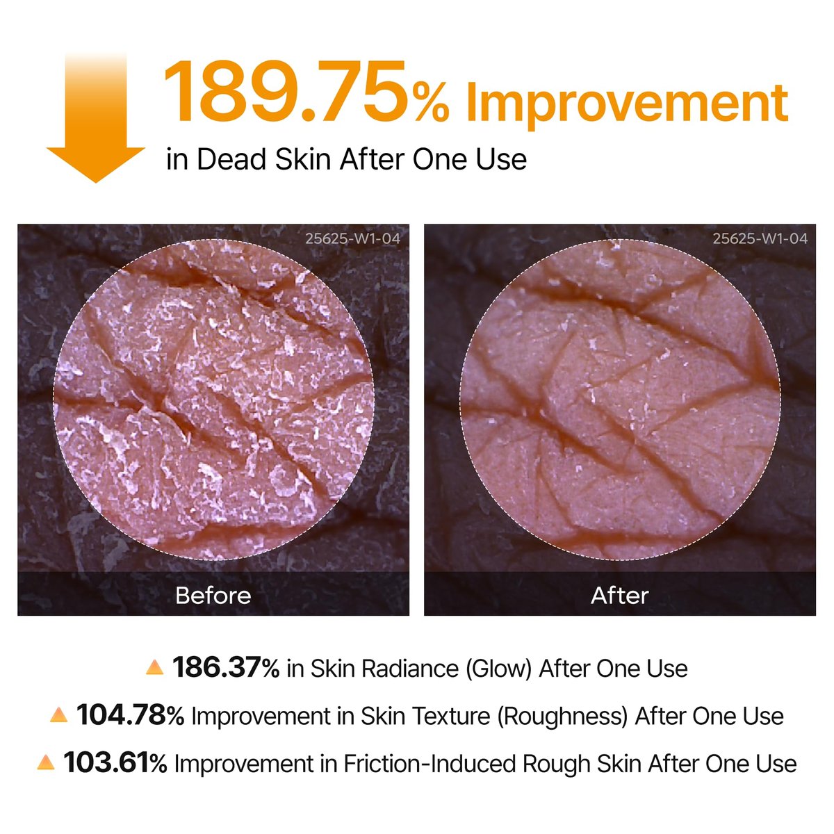 Dr.Melaxin Body Keratin Care Kojic Acid Turmeric Spray with AHA & PHA - Gentle Body Brightening & Exfoliating Peeling Solution, Korean Skincare, 6.76 fl.oz Avelisse