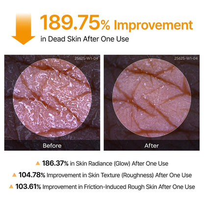 Dr.Melaxin Body Keratin Care Kojic Acid Turmeric Spray with AHA & PHA - Gentle Body Brightening & Exfoliating Peeling Solution, Korean Skincare, 6.76 fl.oz Avelisse