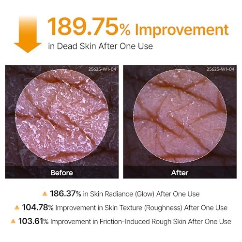 Dr.Melaxin Body Keratin Care Kojic Acid Turmeric Spray with AHA & PHA - Gentle Body Brightening & Exfoliating Peeling Solution, Korean Skincare, 6.76 fl.oz Avelisse