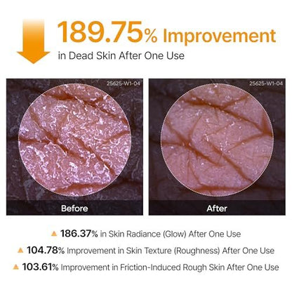 Dr.Melaxin Body Keratin Care Kojic Acid Turmeric Spray with AHA & PHA - Gentle Body Brightening & Exfoliating Peeling Solution, Korean Skincare, 6.76 fl.oz Avelisse