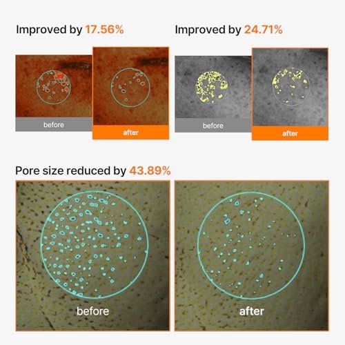 celimax Pore+Dark Spot Brightening Cream Mask 4-Pack | Niacinamide & Tranexamic Acid Sheet Mask for Enlarged Pores, Hyperpigmentation, and Hydration | Korean Skincare Mask - görsel 12