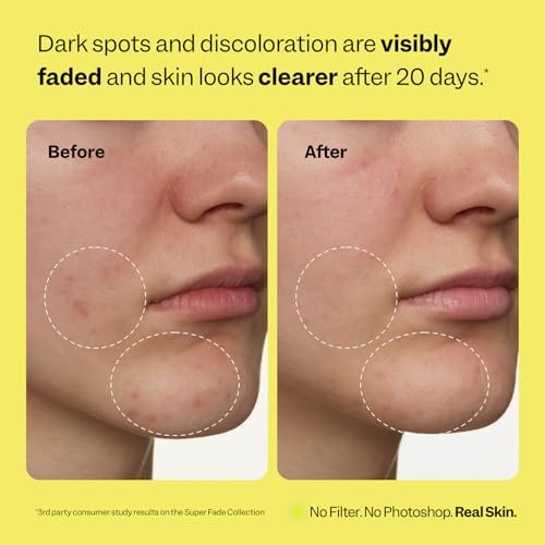 Peach Slices Super Fade Discoloration Serum for Face - Dark Spots & Hyperpigmentation Treatment with Niacinamide and Tranexamic Acid - Vegan & Cruelty Free - Korean Skin Care (1.01 oz) Avelisse