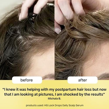 BondiBoost HG Lock Drops Daily Hair Serum for Women – Non-Greasy Hair Thinning Treatment, Stimulates Scalp for Thicker Fuller Hair – Vegan, Color-Safe Lightweight Serum for All Hair Types Avelisse