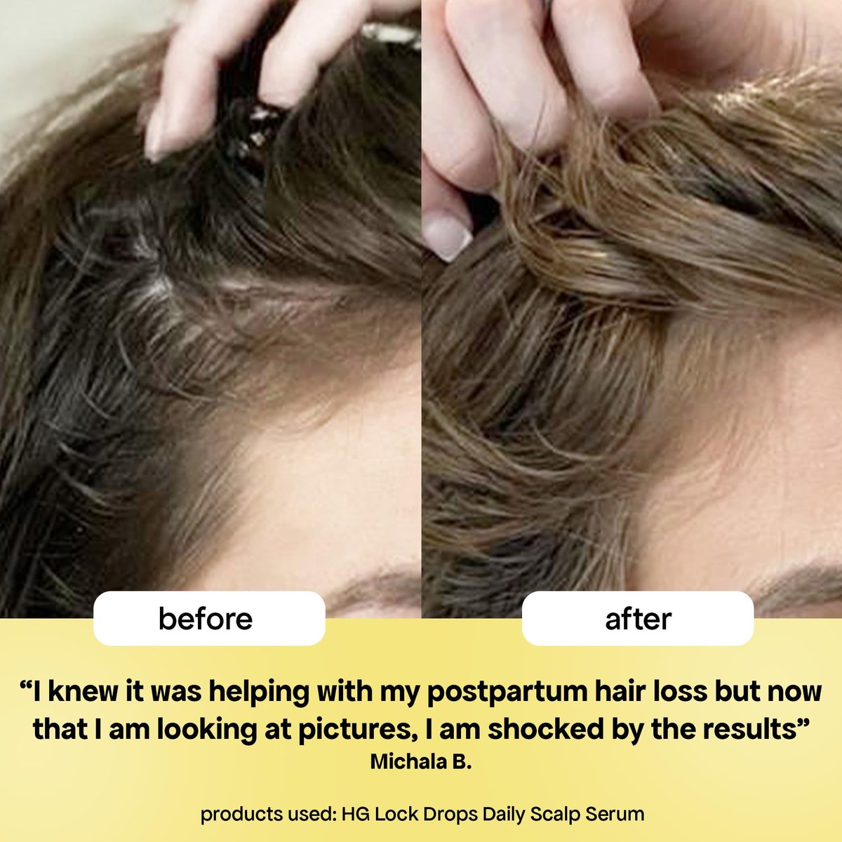 BondiBoost HG Lock Drops Daily Hair Serum for Women – Non-Greasy Hair Thinning Treatment, Stimulates Scalp for Thicker Fuller Hair – Vegan, Color-Safe Lightweight Serum for All Hair Types Avelisse