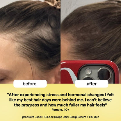 BondiBoost HG Lock Drops Daily Hair Serum for Women – Non-Greasy Hair Thinning Treatment, Stimulates Scalp for Thicker Fuller Hair – Vegan, Color-Safe Lightweight Serum for All Hair Types Avelisse