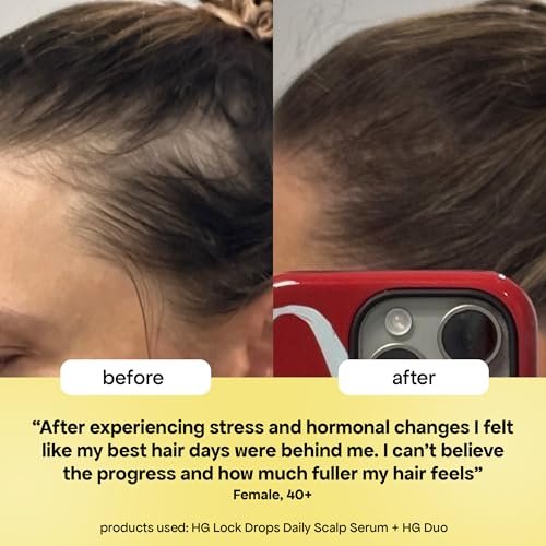BondiBoost HG Lock Drops Daily Hair Serum for Women – Non-Greasy Hair Thinning Treatment, Stimulates Scalp for Thicker Fuller Hair – Vegan, Color-Safe Lightweight Serum for All Hair Types Avelisse