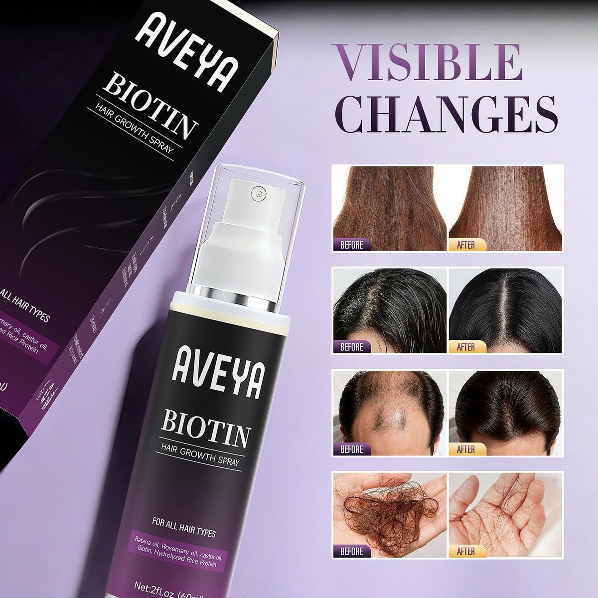 AVEYA Hair Growth Serum for Women & Men – Rosemary Oil, Batana Oil & Biotin – Strengthens, Thickens & Accelerates Hair Care – Non-Greasy – Helps Prevent Hair Thinning & Hair Loss – 60 ml Avelisse
