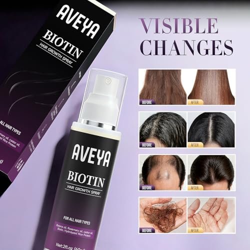 AVEYA Hair Growth Serum for Women & Men – Rosemary Oil, Batana Oil & Biotin – Strengthens, Thickens & Accelerates Hair Care – Non-Greasy – Helps Prevent Hair Thinning & Hair Loss – 60 ml Avelisse