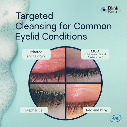 BlinkBetter BetterLids Foaming Eyelid Cleanser – Gentle Daily Foam for Eyelids & Lashes – Soothing Tea Tree Oil Formula with Ectoin & Centella, Non-Stinging, Preservative-Free, 2 fl oz Avelisse