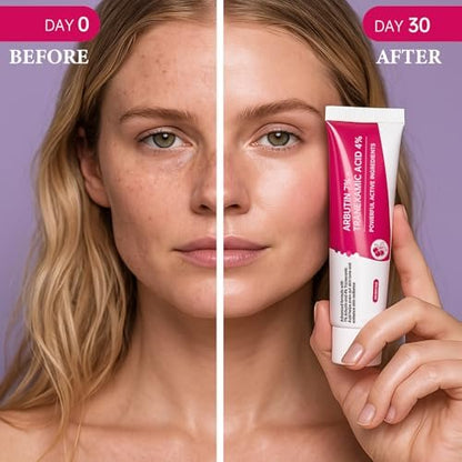 EELHOE Arbutin 7% + Tranexamic Acid 4% Cream - 70,000ppm Arbutin & 40,000ppm TXA - Dark Spot Corrector, Pigmentation Reducer, Even Skin Tone Moisturizer (1.76 fl.oz)