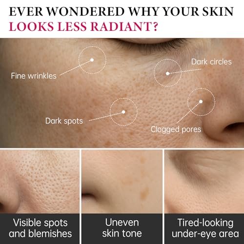 EELHOE Arbutin 7% + Tranexamic Acid 4% Cream - 70,000ppm Arbutin & 40,000ppm TXA - Dark Spot Corrector, Pigmentation Reducer, Even Skin Tone Moisturizer (1.76 fl.oz) - görsel 6