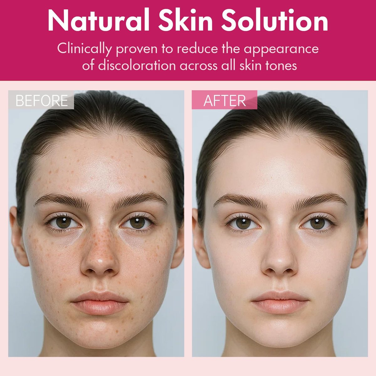 Roseblem Arbutin 7% + Tranexamic Acid 4% Face Cream for Dark Spots & Uneven Skin Tone – Hydrating, Non-Irritating, Safe for Sensitive Skin 1.76 oz - görsel 10