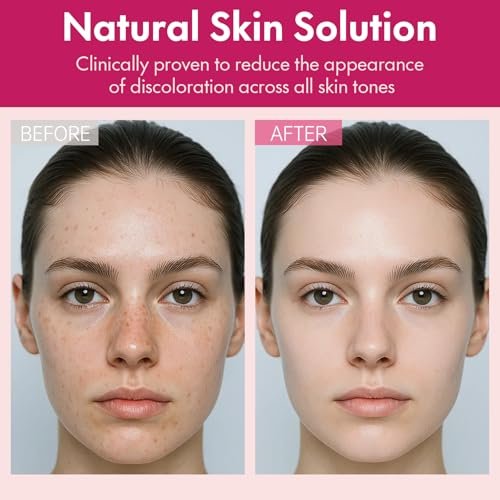 Roseblem Arbutin 7% + Tranexamic Acid 4% Face Cream for Dark Spots & Uneven Skin Tone – Hydrating, Non-Irritating, Safe for Sensitive Skin 1.76 oz - görsel 9