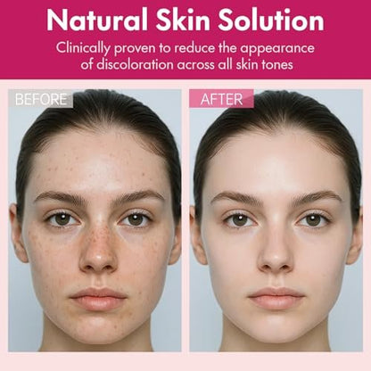 Roseblem Arbutin 7% + Tranexamic Acid 4% Face Cream for Dark Spots & Uneven Skin Tone – Hydrating, Non-Irritating, Safe for Sensitive Skin 1.76 oz