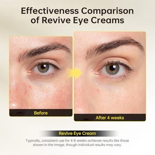 Revive Eye Cream with Retinal and Niacinamide – Reduces Under-Eye Bags, Fine Lines, Dark Circles, and Wrinkles – Stimulates Cell Renewal and Firms Skin – Korean Skin Care, 40g (1.40 fl. oz) Avelisse
