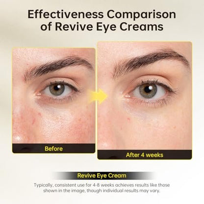 Revive Eye Cream with Retinal and Niacinamide – Reduces Under-Eye Bags, Fine Lines, Dark Circles, and Wrinkles – Stimulates Cell Renewal and Firms Skin – Korean Skin Care, 40g (1.40 fl. oz) Avelisse
