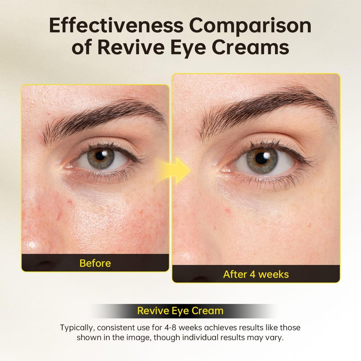 Revive Eye Cream with Retinal and Niacinamide – Reduces Under-Eye Bags, Fine Lines, Dark Circles, and Wrinkles – Stimulates Cell Renewal and Firms Skin – Korean Skin Care, 40g (1.40 fl. oz) Avelisse