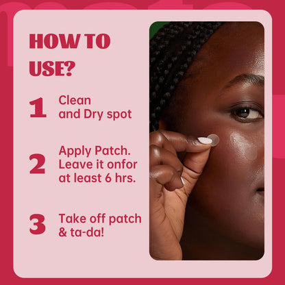 Materasu Pimple Patches for Face & Nose – 192 Hydrocolloid Acne Patches with Salicylic Acid, Tea Tree Oil & Calendula Oil (8mm, 10mm, 12mm) – 3 Sizes + 2 Nose Patches