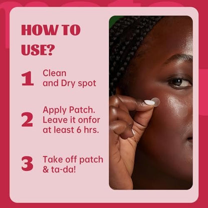 Materasu Pimple Patches for Face & Nose – 192 Hydrocolloid Acne Patches with Salicylic Acid, Tea Tree Oil & Calendula Oil (8mm, 10mm, 12mm) – 3 Sizes + 2 Nose Patches