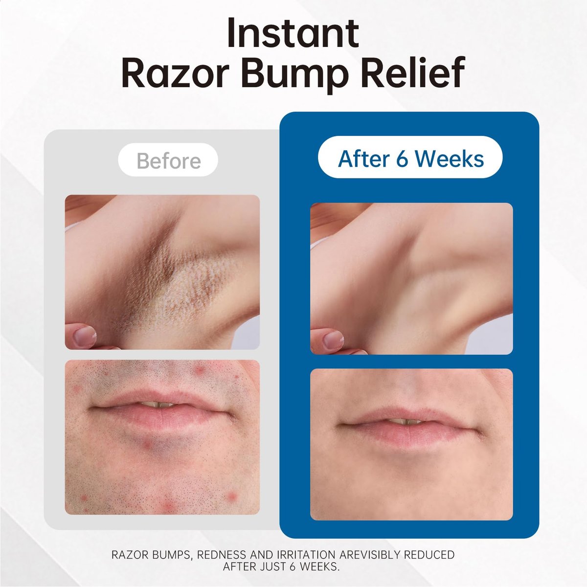 Razor Bumps & Ingrown Hair Treatment – Smoothing Solution for Body, Beard & Bikini Area – Post Waxing & After Shaving Serum for Women & Men - görsel 5