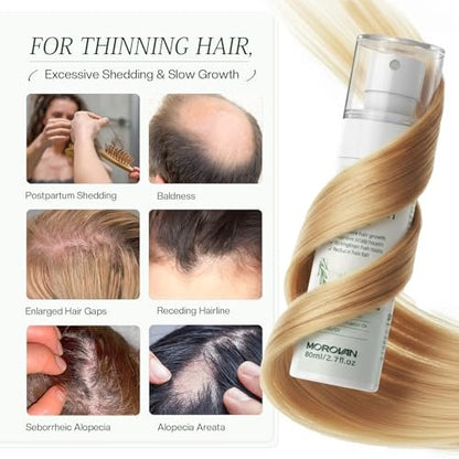 Morovan Hair Growth Spray for Scalp - Batana & Castor Oil Hair Loss Treatment, 2.7 fl oz