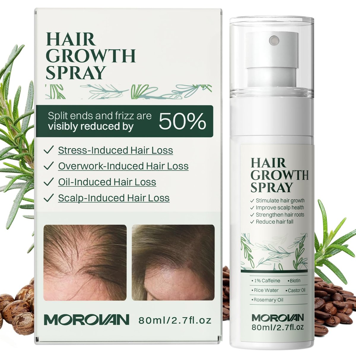 Morovan Hair Growth Spray for Scalp - Batana & Castor Oil Hair Loss Treatment, 2.7 fl oz - görsel 1