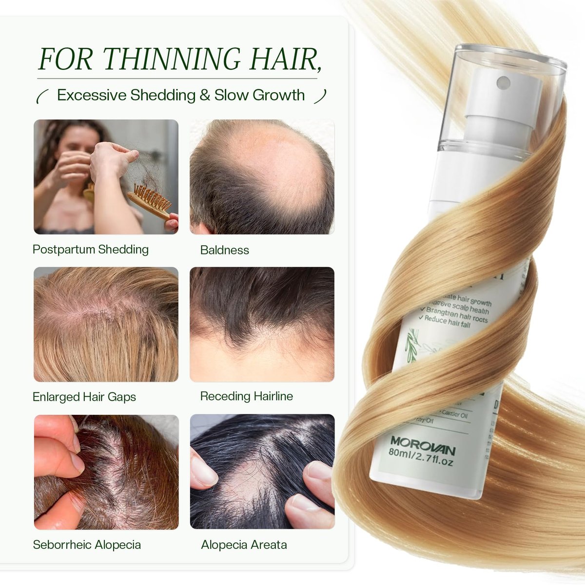 Morovan Hair Growth Spray for Scalp - Batana & Castor Oil Hair Loss Treatment, 2.7 fl oz - görsel 7