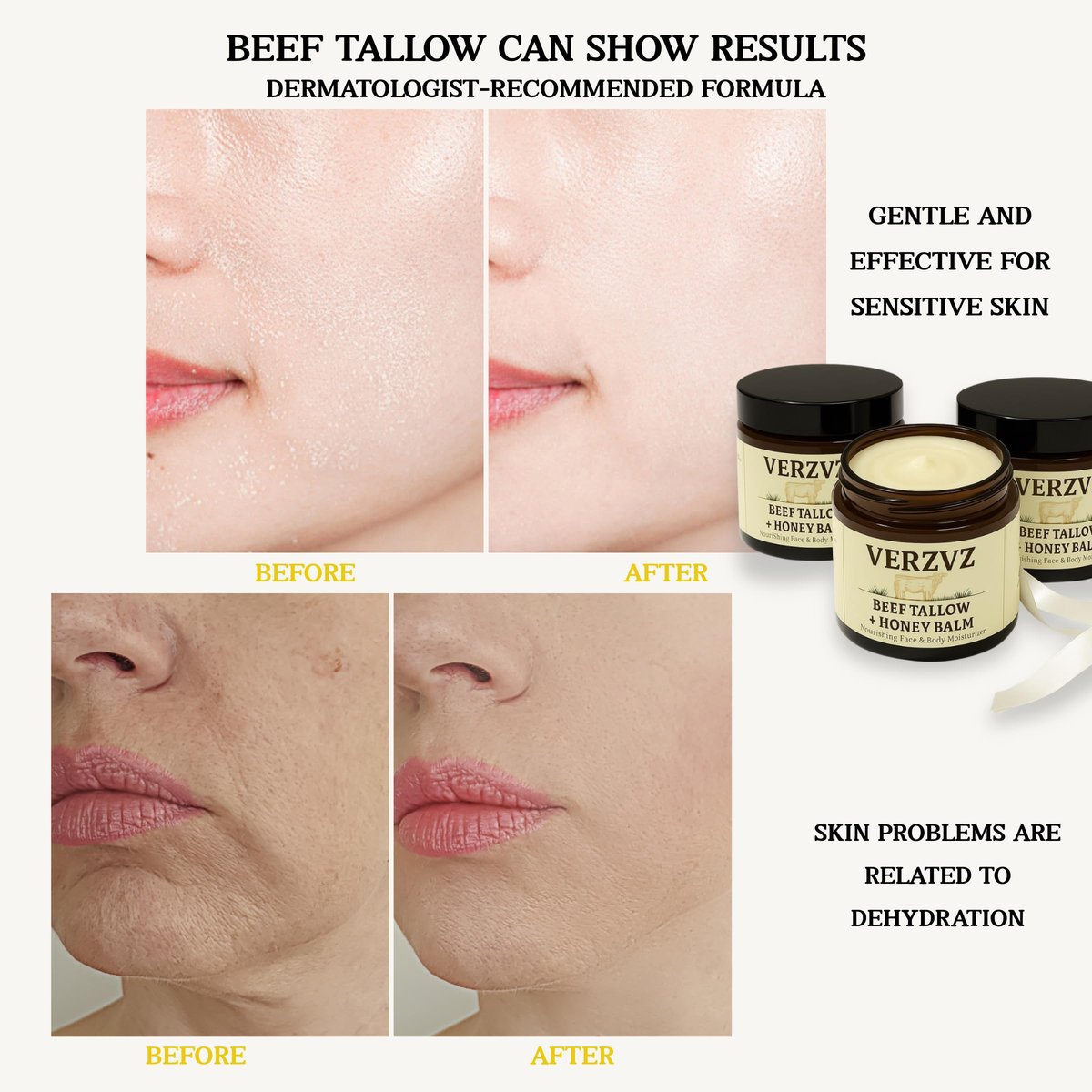 Beef Tallow for Skin and Face – Tallow and Honey Balm Moisturizer, 100% Grass-Fed Beef Tallow with Raw Organic Honey, Beeswax, Olive Oil & Vitamin E – Deep Hydration – Proudly Made in USA – 2oz Avelisse