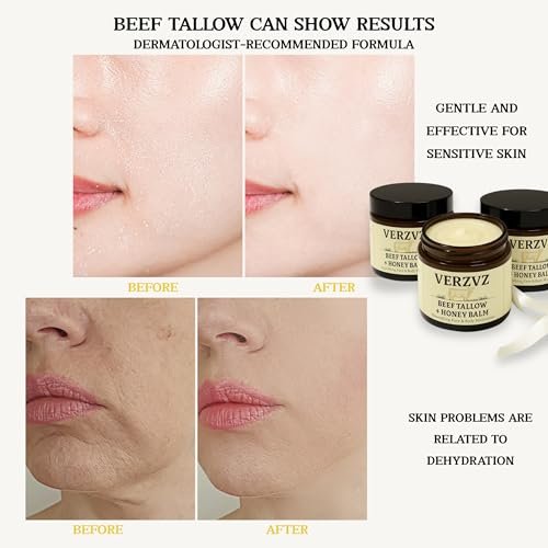 Beef Tallow for Skin and Face – Tallow and Honey Balm Moisturizer, 100% Grass-Fed Beef Tallow with Raw Organic Honey, Beeswax, Olive Oil & Vitamin E – Deep Hydration – Proudly Made in USA – 2oz Avelisse