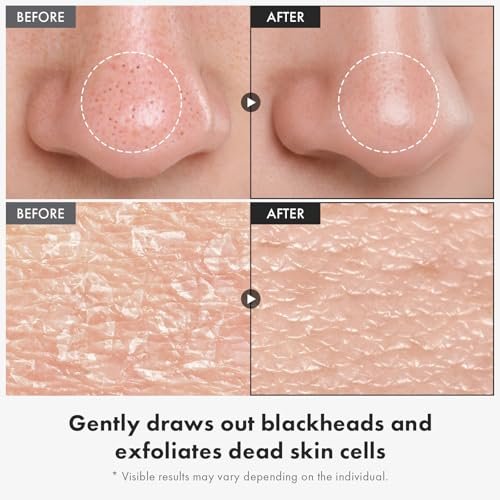 TOSOWOONG Black Rice Peeling Ampoule – 75% Black Rice Exfoliant, Dead Skin Remover, Face & Body Scrub, Blackheads & Pore Cleaner, Kojic Acid & Arbutin for Discoloration, Korean Skincare, 85ml / 2.87 fl. oz. Avelisse