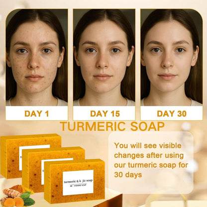 3PCS Turmeric Soap Set: Honey Lemon Turmeric Kojic Soap Bars for Face and Body - Organic Daily Use, Deep Cleansing & Moisturizing, Handmade for All Skin Types Avelisse
