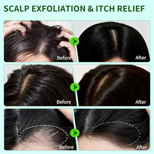 Criszenv Scalp Scrub with Rosemary & Mint – Clarifying Exfoliator for Itchy Scalp, Dandruff & Buildup Removal, 8.8 oz - görsel 8