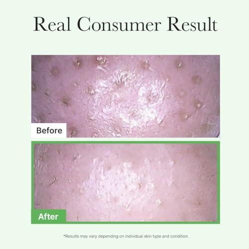 ARENCIA Pore Melt Mochi Makeup-Removing Cleansing Oil – Non-Comedogenic, Rice Amino Acids, Vitamin E, Cica & Ceramide, 6.76 fl oz - görsel 13