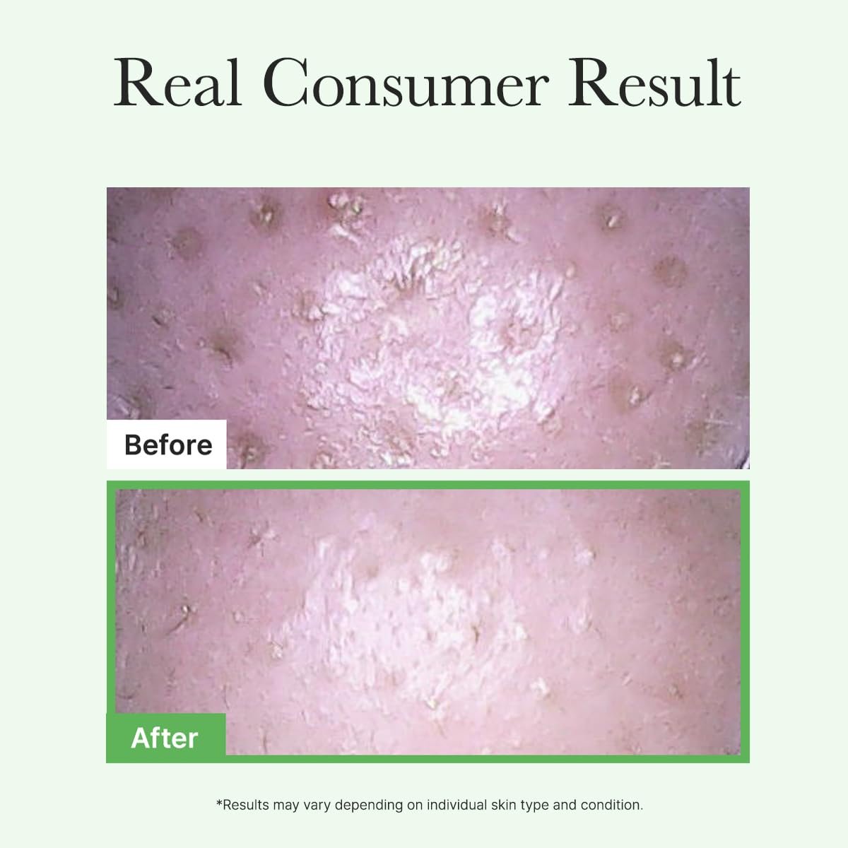 ARENCIA Pore Melt Mochi Makeup-Removing Cleansing Oil – Non-Comedogenic, Rice Amino Acids, Vitamin E, Cica & Ceramide, 6.76 fl oz - görsel 14